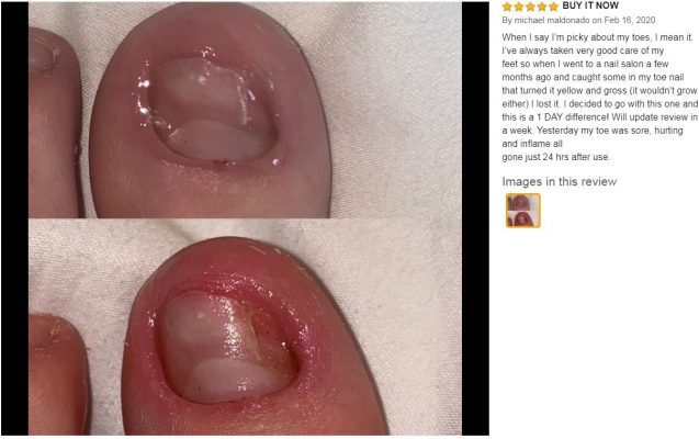 Kerasal Review - Visible Results In Just 1 Week! | Nail Care Hub