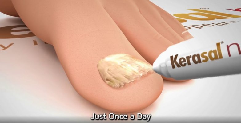 Kerasal Fungal Nail Renewal Treatment