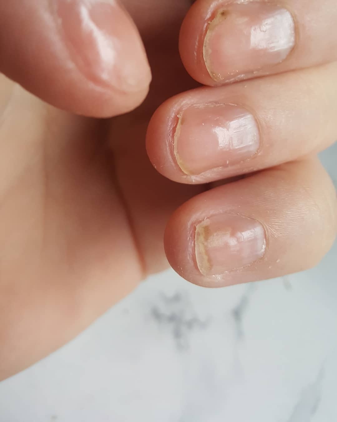 How To Fix Weak Nails Nail Care Hub