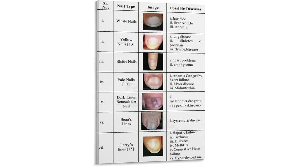 nail health chart poster