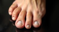 athlete nail injury prevention