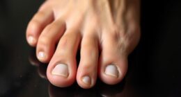 athlete nail injury prevention