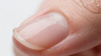 adhesion depends on surface