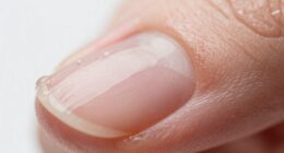 adhesion depends on surface