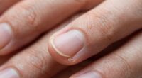 aging affects cuticle function