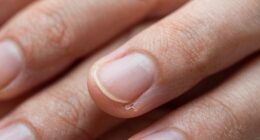 aging affects cuticle function