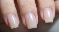gel overlays cracking issues