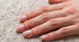 gentle nail recovery routine