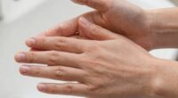 hand sanitizer effects on skin