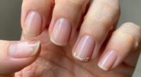 hormonal changes affect nails