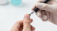 manage nail infections professionally