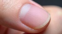 nail bed promotes growth