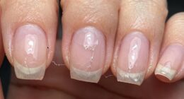 nail damage from cycling