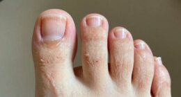 nail growth rate differences