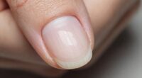 nail layers improve retention