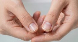 water damages nail strength